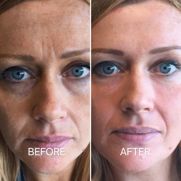 Before and after using the mask