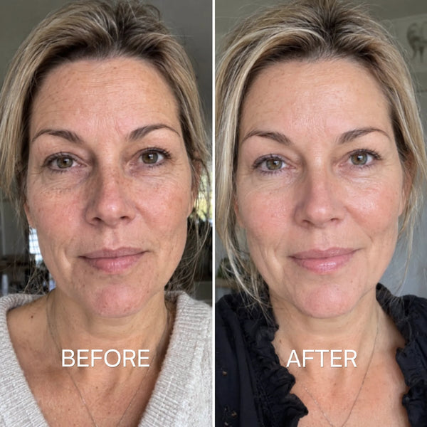 Before and after using the mask