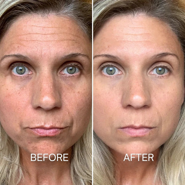 Before and after using the mask