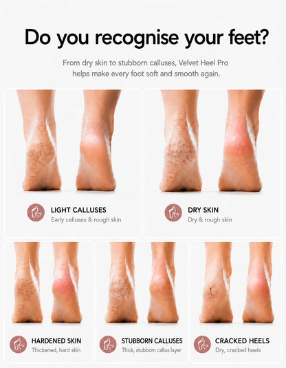 Do you recognise your feet?